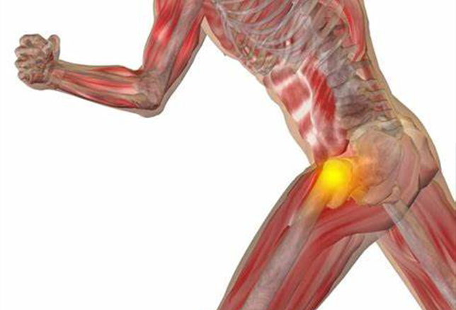 Impacto femoroacetabular